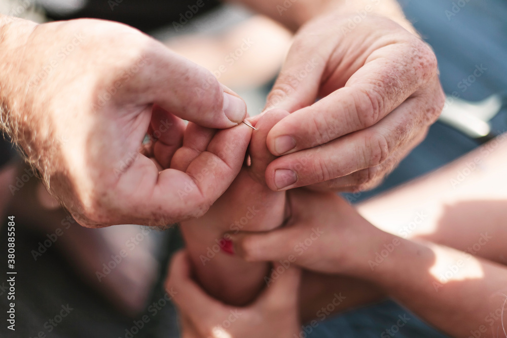 Parent Removing Splinter from Foot Parent Removing Splinter from Foot