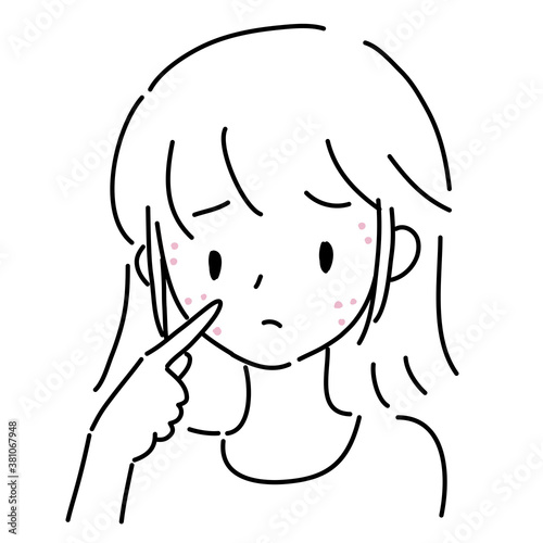 ニキビに悩む若い女性