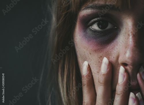 Beaten woman standing in front of a dark wall demonstrating violence on women. photo