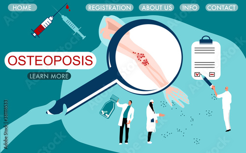 World Osteoporosis Day concept. Magnifier with brittle,porous and fragile bone.Tiny doctors make laboratory tests.Website template with arthrosis human hand.Elbow joint disease.Vitamin D deficiency