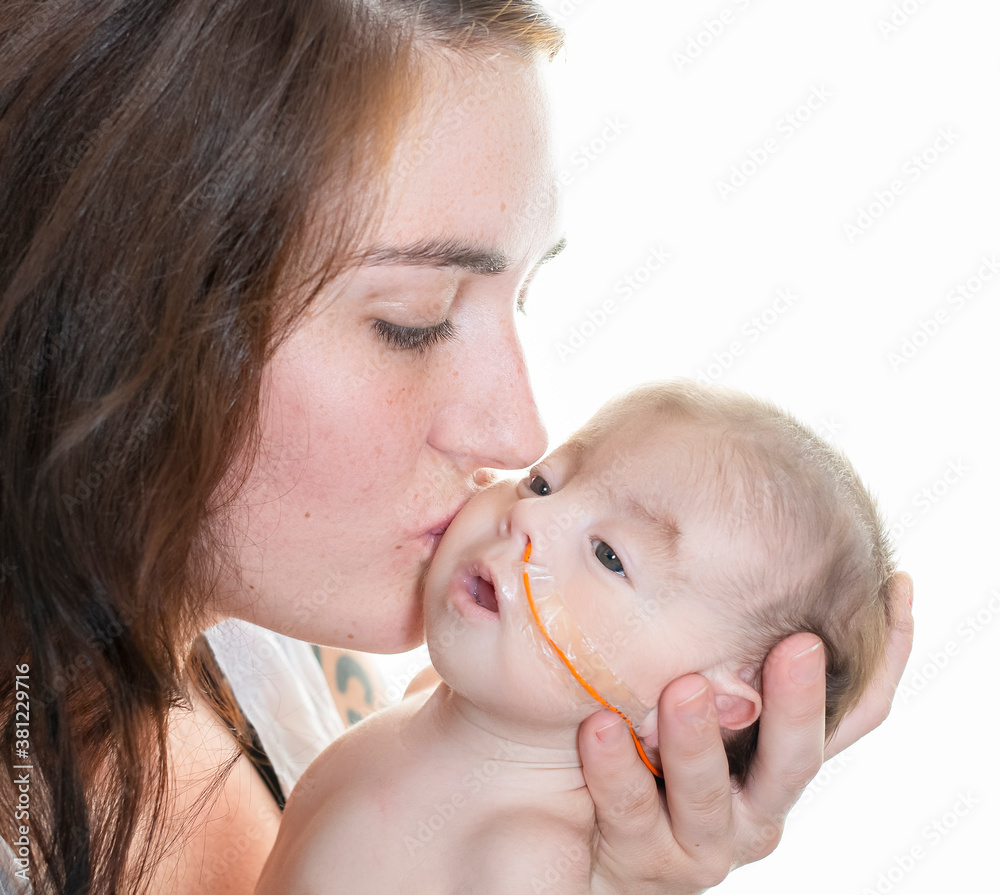 Close up young mother kissing cheek of special needs infant with feeding  tube Stock Photo | Adobe Stock