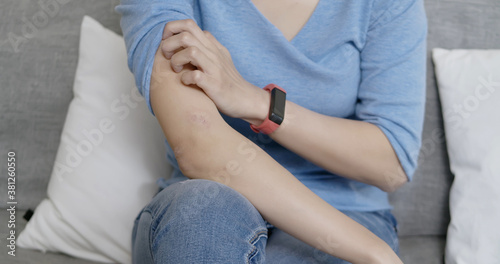woman has dry skin