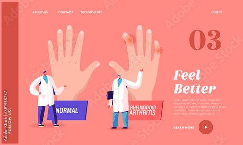 Rheumatoid Arthritis Sickness Landing Page Template. Doctor Arthrologist Pointing on Huge Hand with Joints Disease