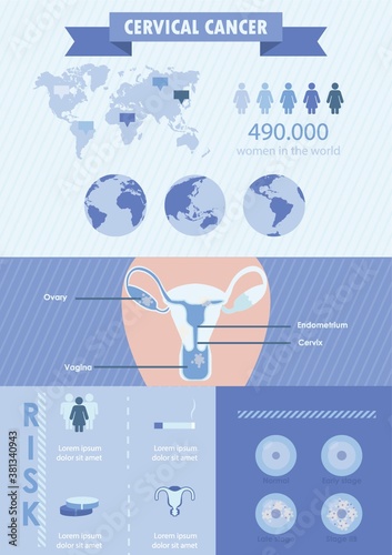 Cervical cancer infographic design