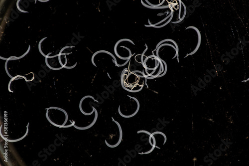 Schistosoma is a genus of trematodes, commonly known as blood flukes for education in laboratory. photo