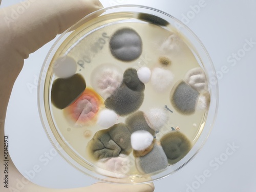 Results of culture of various fungal bacteria
