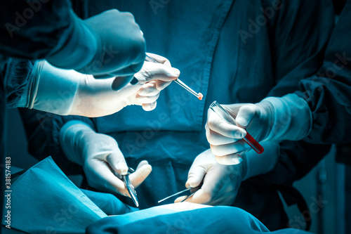 concentrated professional surgical doctor team operating surgery a patient in the operating room at hospital. tumor cancer. surgical biopsy specimens. healthcare and medical concept.