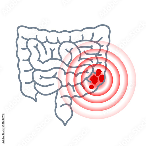 Colon cancer icon (Colorectal or bowel cancer) - human intestine and pain circles