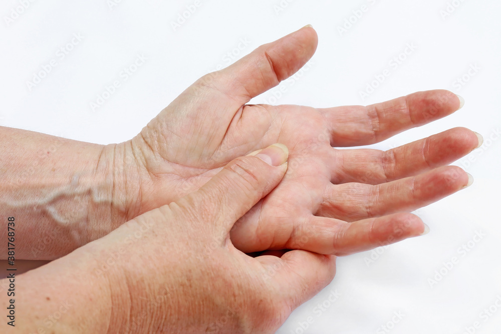 Fototapeta premium Eine Frau hat Schmerzen in Händen und Fingern