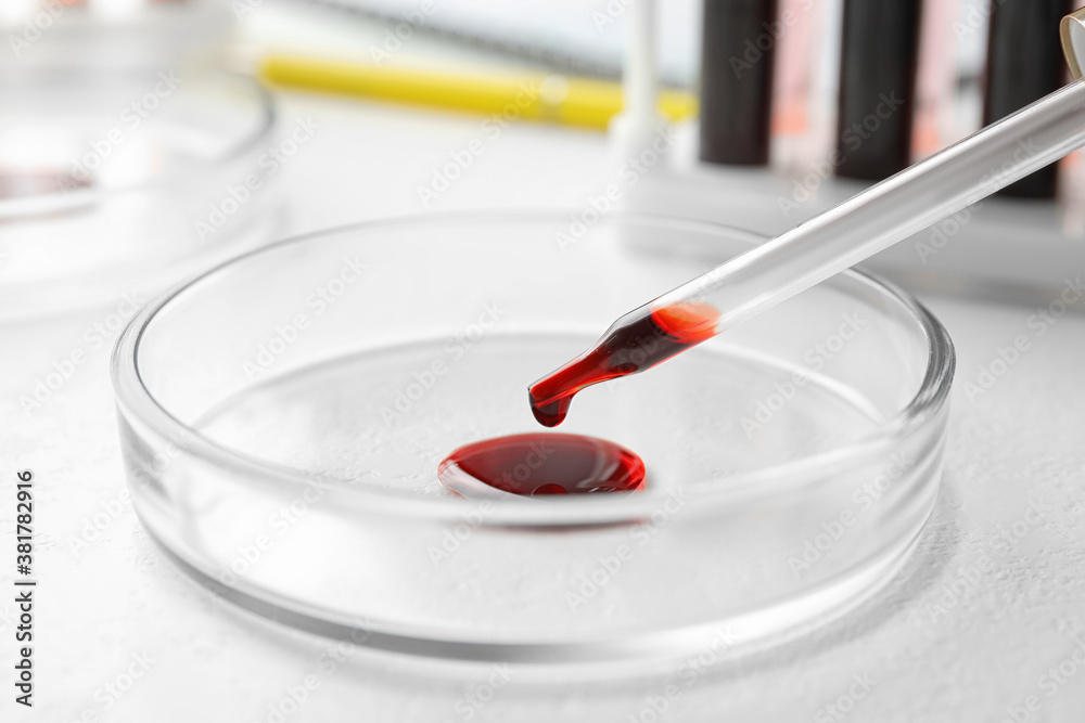 Dripping blood from pipette into Petri dish on table, closeup. Laboratory analysis Dripping blood from pipette into Petri dish on table, closeup. Laboratory analysis