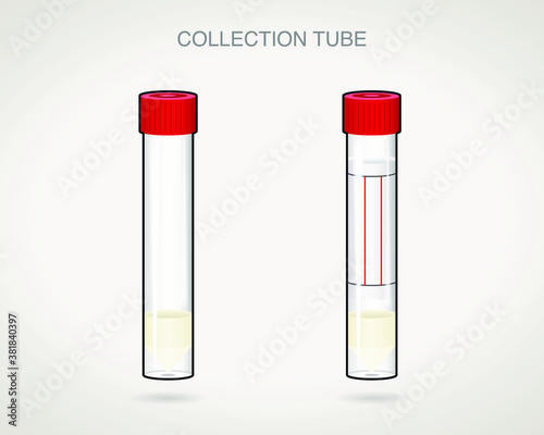 Swab Disposable Virus Sampling Tube, Virus Transport Sampling Specimen Collection Tube, Virus Specimen Collection Tube