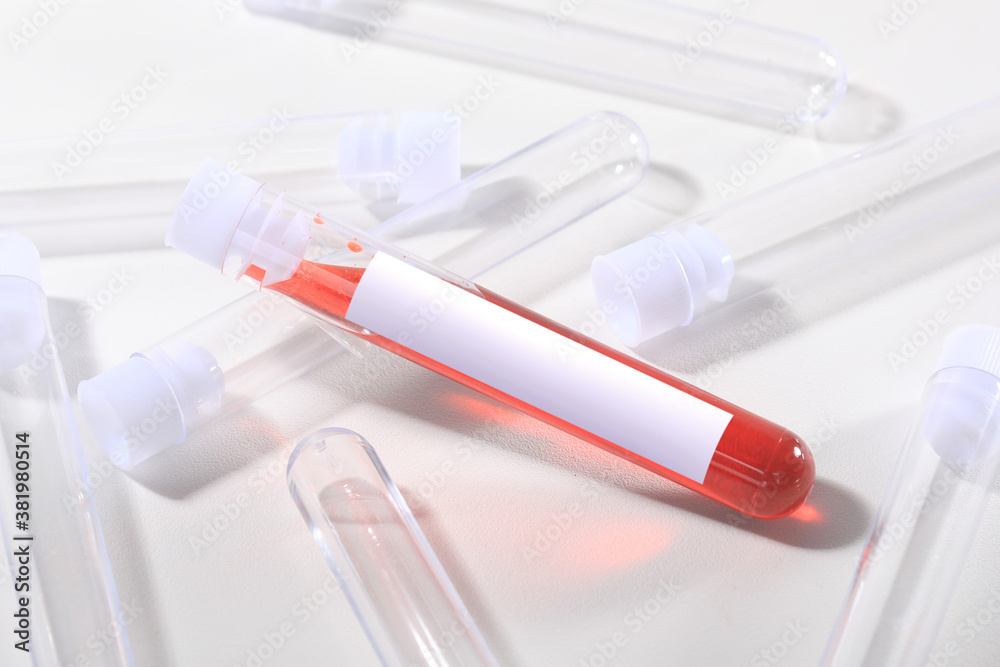 Blood Testing Tubes on White With Label Blood Testing Tubes on White With Label
