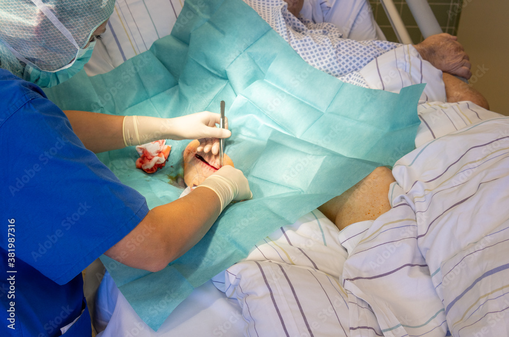  doctor sutures a long surgical wound with a needle holder and tweezers