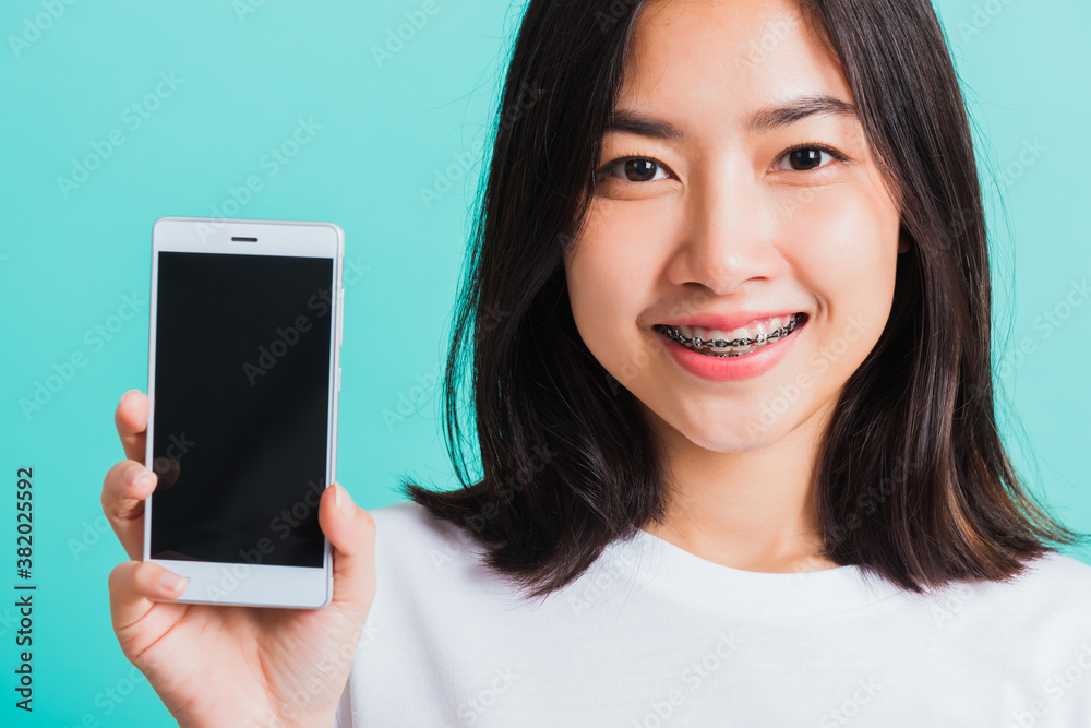 Portrait of Asian teen beautiful young woman smile have dental braces on teeth laughing she hold and show smart mobile phone blank screen, isolated on blue background, Medicine and dentistry concept