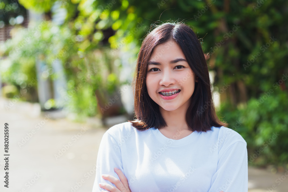 Portrait of Asian teen beautiful young woman smile have dental braces on teeth laughing outdoor, Medicine and dentistry concept Portrait of Asian teen beautiful young woman smile have dental braces on teeth laughing outdoor, Medicine and dentistry concept