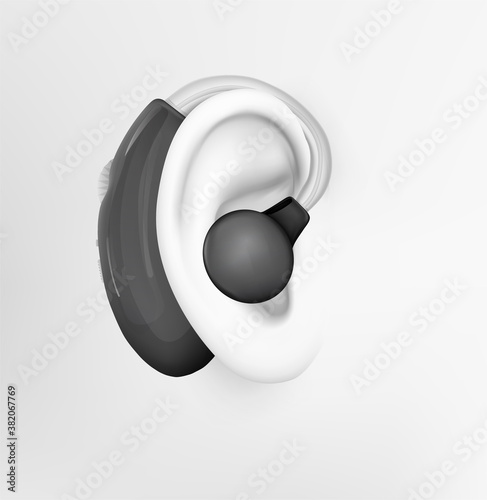 vector human ear. hearing treatment, plastic surgery, implantation
