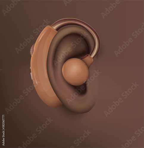 vector human ear. hearing treatment, plastic surgery, implantation