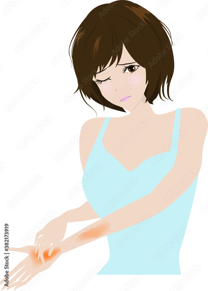 手と腕が乾燥して痒くてたまらない綺麗な女性のイラスト Stock Vector Adobe Stock