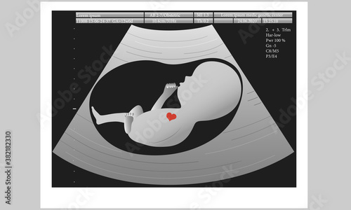 Ultrasound of unborn baby in mother's womb, medical concept, vector illustration.