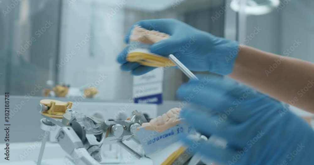 A technician is taking a model of the upper teeth out of a metal device A technician is taking a model of the upper teeth out of a metal device