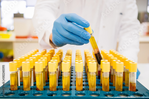Crop person in latex gloves taking blood sample from tray while working in modern laboratory