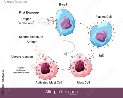 Mechanism of Human allergic reaction caused by a foreign substance or Allergens like pollen grain which are harmless but lead to hypersensitivity and activation of Mast cell degranulation vector eps photo