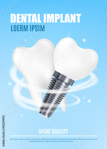 Vector medical poster with realistic illustration dental implant and human tooth
