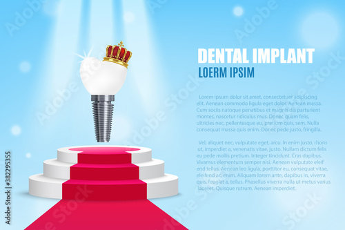 Vector advertising banner with realistic illustration dental implant