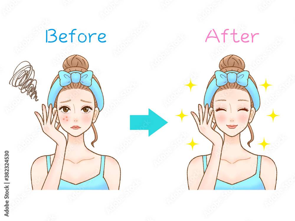 スキンケアのビフォーアフター スキンケアのビフォーアフター