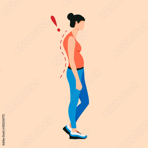 Osteoporosis flat cartoon illustration. Curve posture, back pain, spine injury. Rachiocampsis.