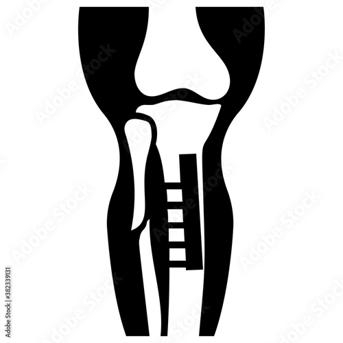 
Knee joint icon vector
