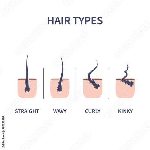 Straight, wavy, curly, kinky hair types classification set. Skin cross-section with follicles. Human hair growth style chart. Health care and beauty concept. Vector illustration.