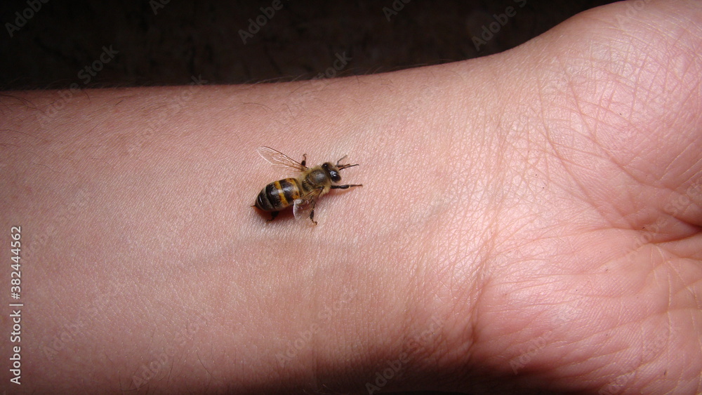 Obraz premium bee : apis mellifera treatment by honey bee sting closeup honey bee stinging a hand close up bee worker insects, insect, animal, wildlife, wild nature, forest, woods, garden beauty of pollination