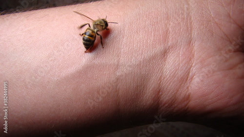 Fotografi bee : apis mellifera treatment by honey bee sting closeup honey bee stinging a h