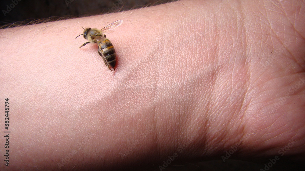 bee : apis mellifera treatment by honey bee sting closeup honey bee stinging a hand close up bee worker insects, insect, animal, wildlife, wild nature, forest, woods, garden beauty of pollination