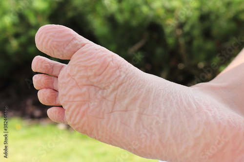 Принти на полотні Wrinkled foot after long bath