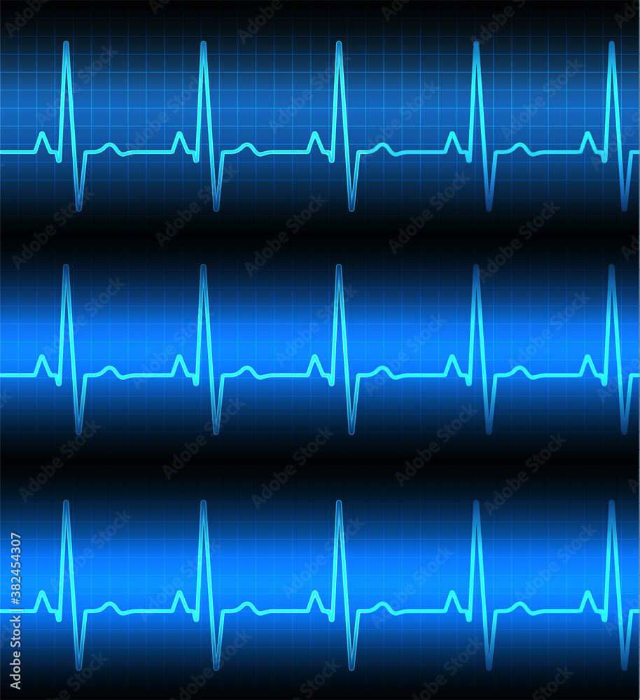 Heart rate graph. Heart beat. Ekg icon wave. Turquoise color. Stock vector illustration