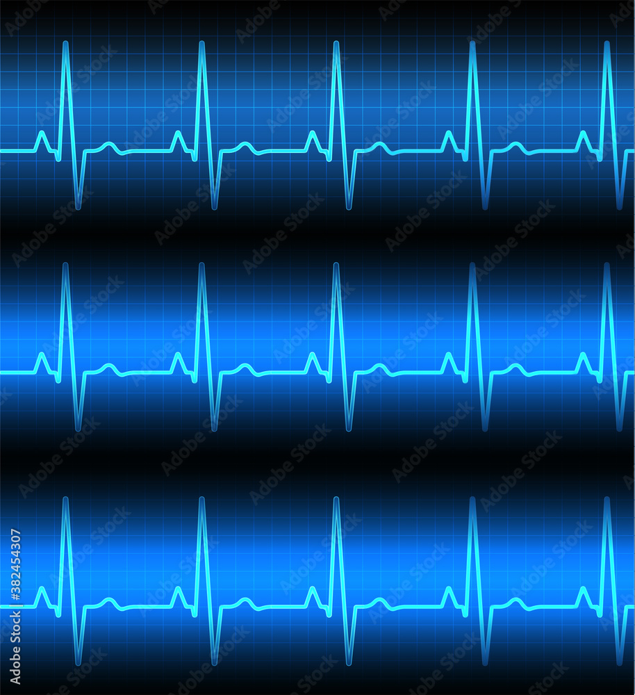 Heart rate graph. Heart beat. Ekg icon wave. Turquoise color. Stock vector illustration Heart rate graph. Heart beat. Ekg icon wave. Turquoise color. Stock vector illustration