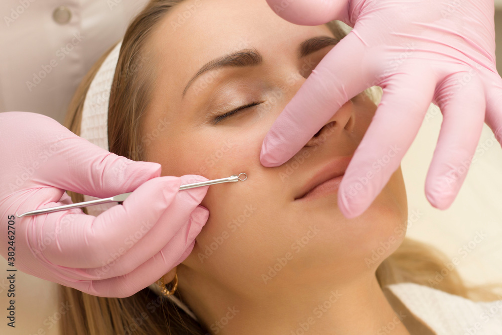 Procedure for cleaning skin with steel tool from blackheads and acne. Deep cleansing of the female face with blackhead remover in the beauty salon. Cosmetologist making receiving cleansing therapy Procedure for cleaning skin with steel tool from blackheads and acne. Deep cleansing of the female face with blackhead remover in the beauty salon. Cosmetologist making receiving cleansing therapy