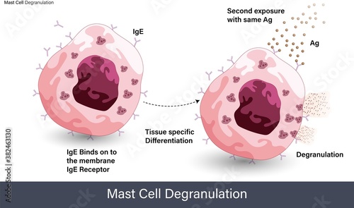 mechanism Of Mast cell degranulation during the allergic reaction induced by allergens like pollen grain vector photo