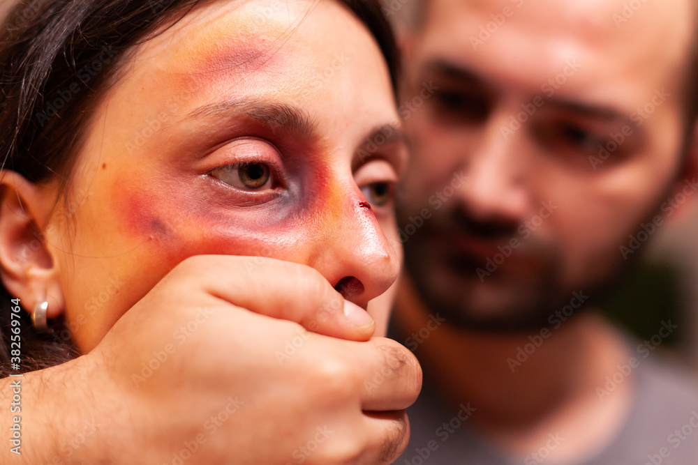 Close upf woman with bruises because of agressive husband. Violent aggressive husband abusing injuring terrified helpless, vulnerable, afraid, beaten and panicked wife. Close upf woman with bruises because of agressive husband. Violent aggressive husband abusing injuring terrified helpless, vulnerable, afraid, beaten and panicked wife.