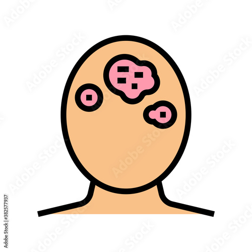 seborrhoeic dermatitis skin disease color icon vector. seborrhoeic dermatitis skin disease sign. isolated symbol illustration