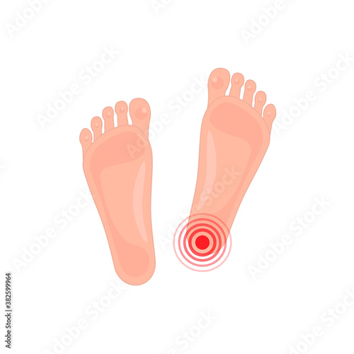 spur and pain of human foot