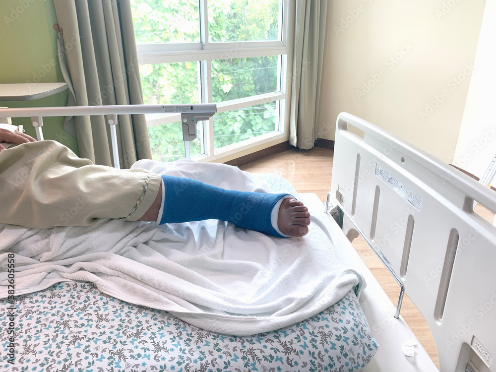 Shackled Foot Disabled Injured Person With Sprained or Broken Ankle or Foot. patient ...