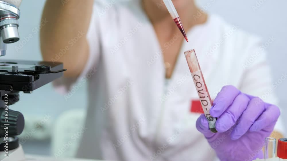 Positive COVID-19 test and laboratory sample of blood testing for diagnosis new Corona virus infection with hospital background Positive COVID-19 test and laboratory sample of blood testing for diagnosis new Corona virus infection with hospital background