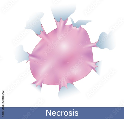 Mechanism of Necrosis. Cell bursting. Plasma membrane rupture. Cell damage and death. vector of Necrosis. 
