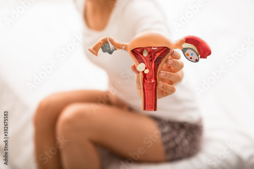 unrecognizing woman with abdominal pain holds the anatomical model of uterus and ovaries with pathology. diseases uterus and ovaries, endometriosis, ovarian cysts photo