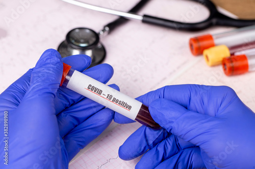 Test tube with blood test i...