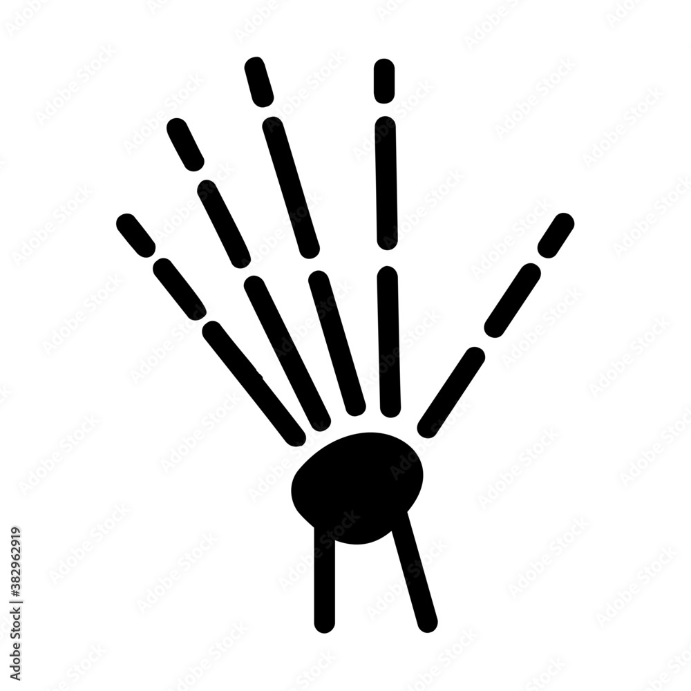 Hand xray Hand xray