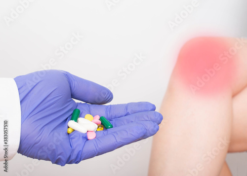 The doctor holds a handful of pills against the background of the girl's legs and knees. Concept of drug treatment for knee diseases of arthrosis and bursitis, chondroprotectors and anti-inflammatory photo